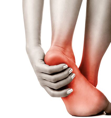 plantar fasciitis webmd